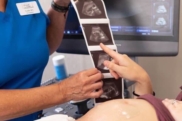 See The Impact A woman seeing her ultrasound provided by ICU Mobile